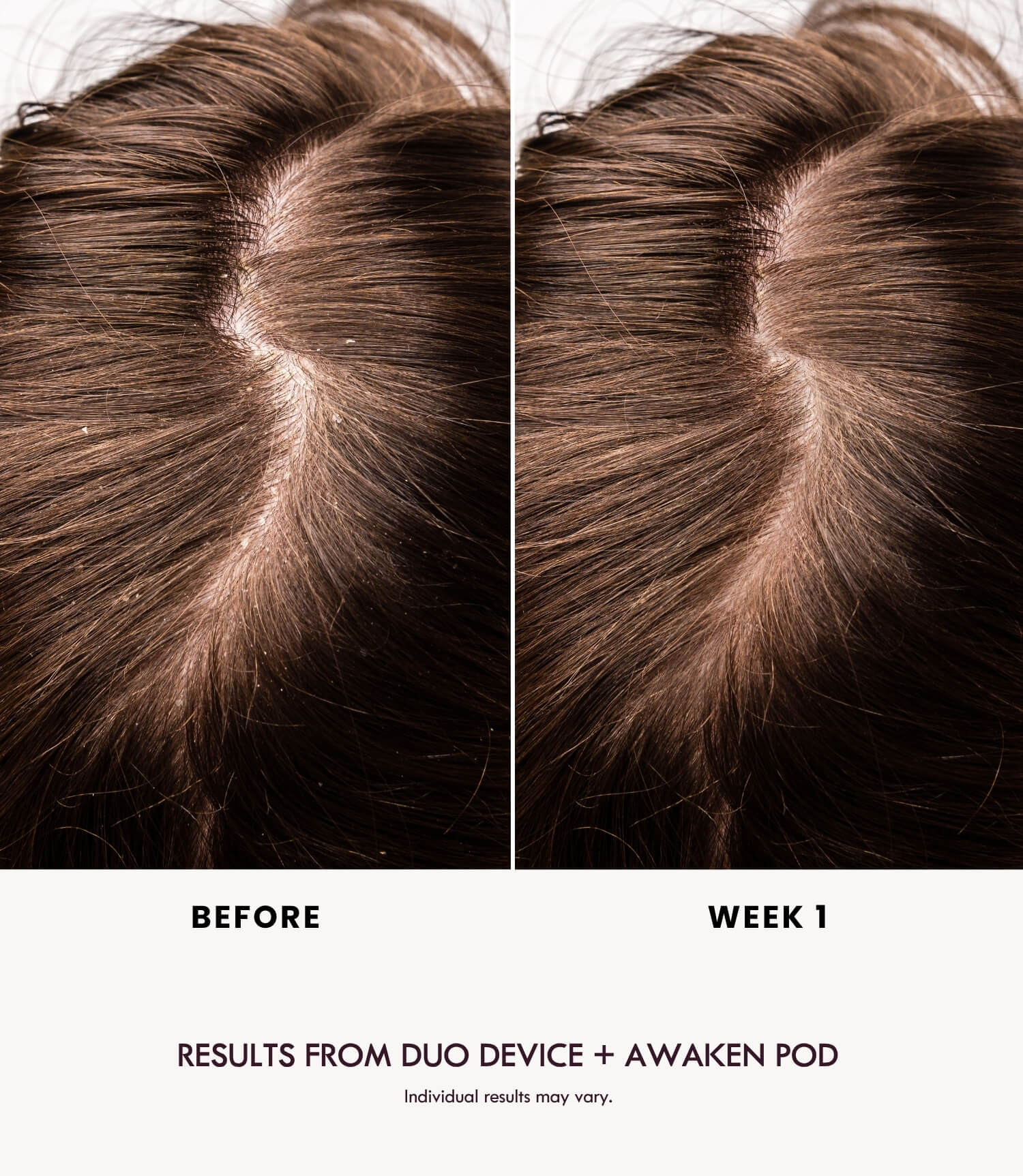 AWAKEN DUO POD - LADUORA