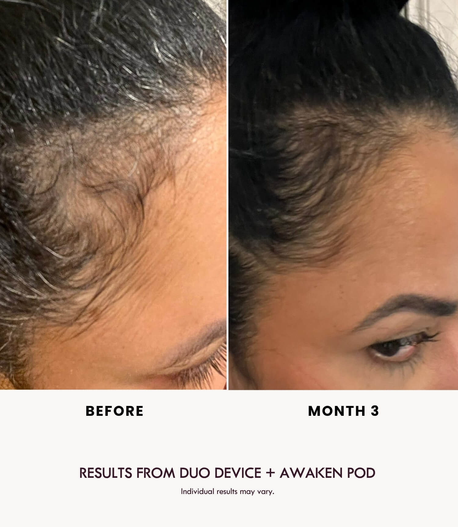 AWAKEN DUO POD - LADUORA