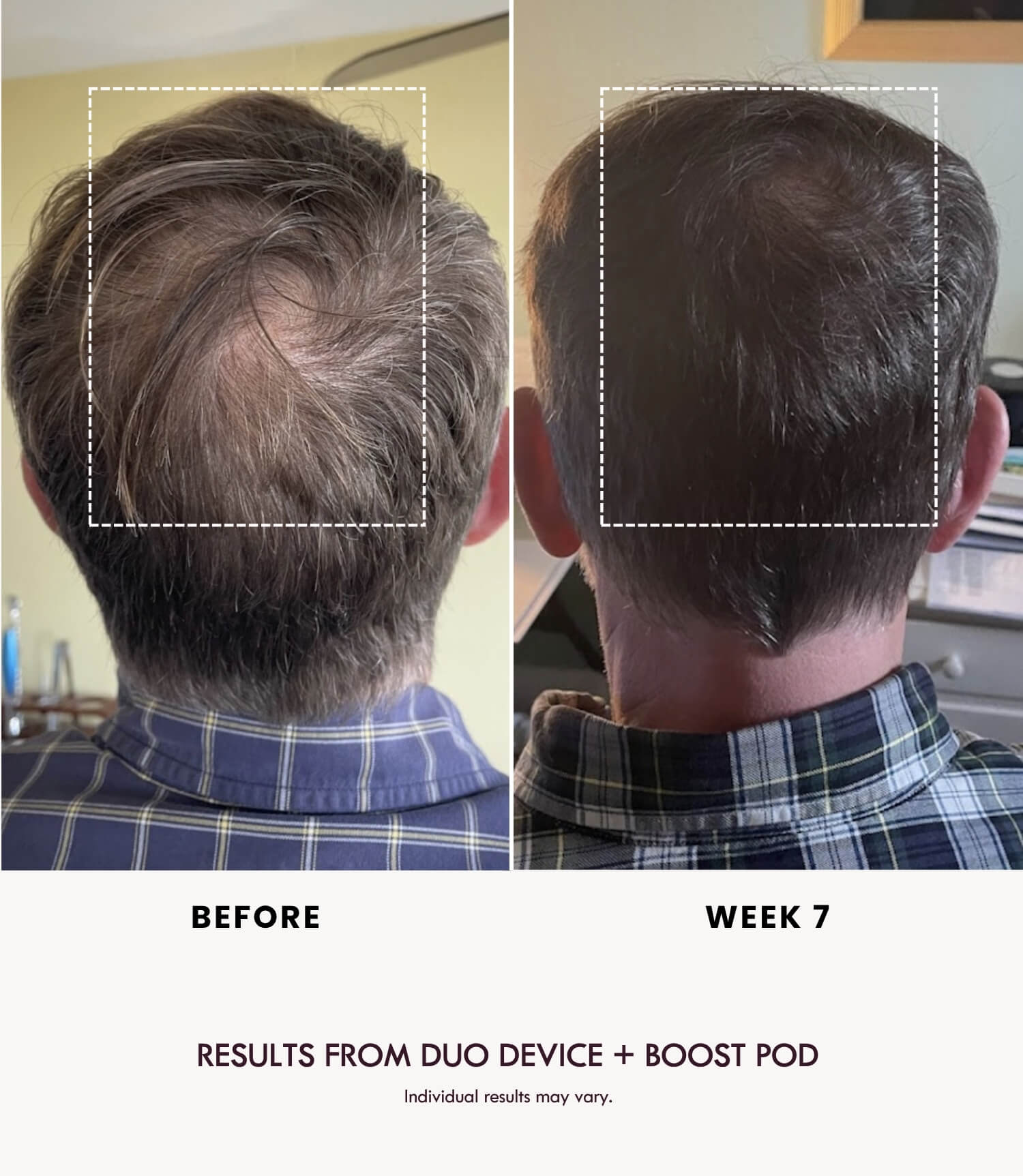 BOOST DUO POD - LADUORA