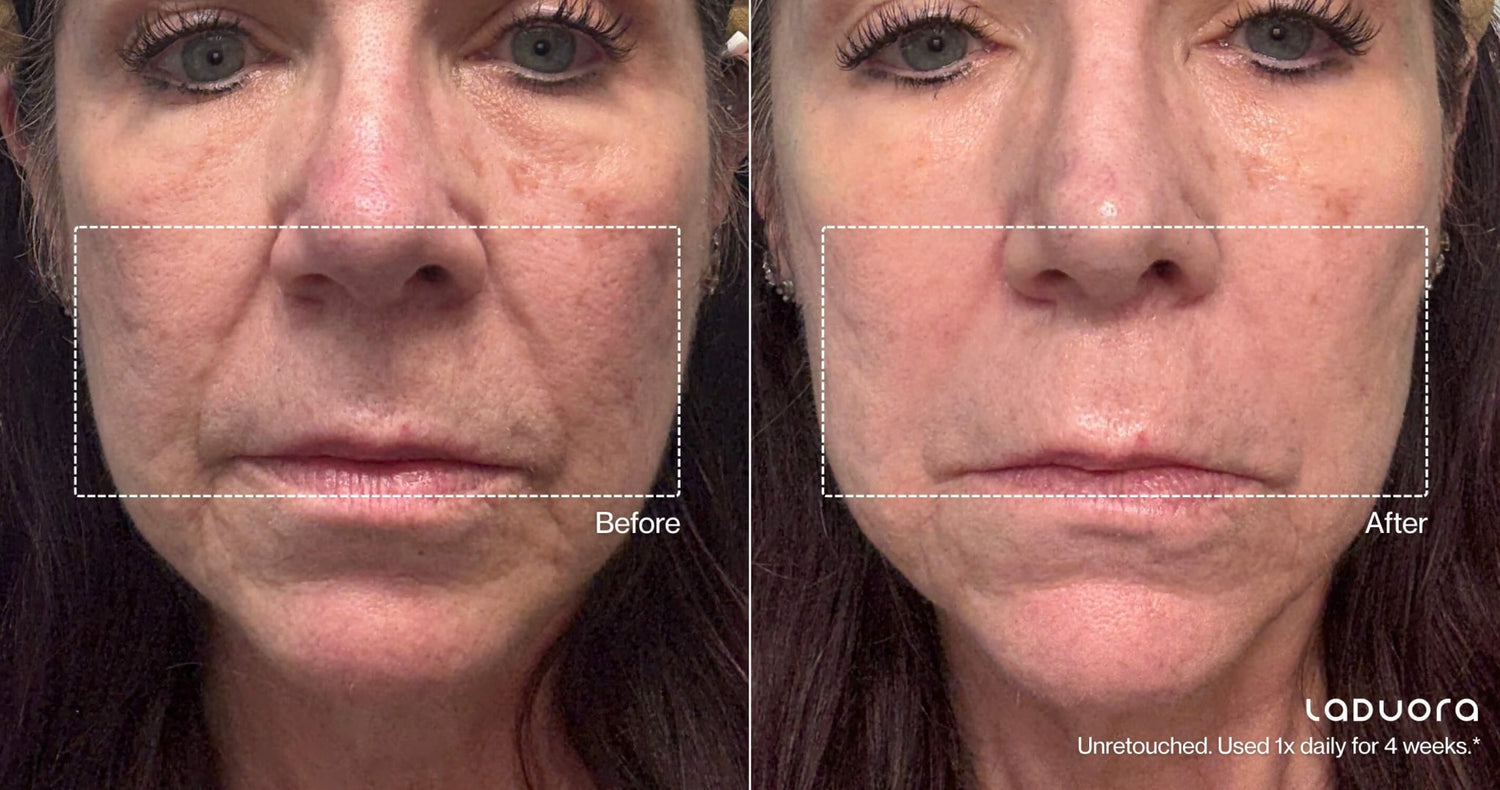 Red Light Therapy Before and After: 7 Results to Look For (and the Science Behind Them) - Laduora