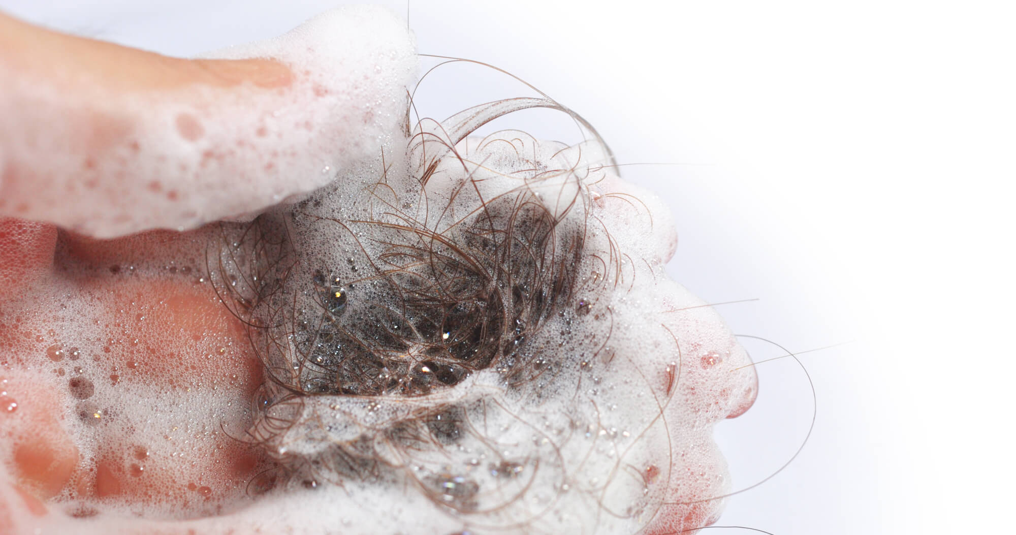 The 5 Root Causes Of Hair Thinning: Symptoms, Causes & Treatments - LADUORA