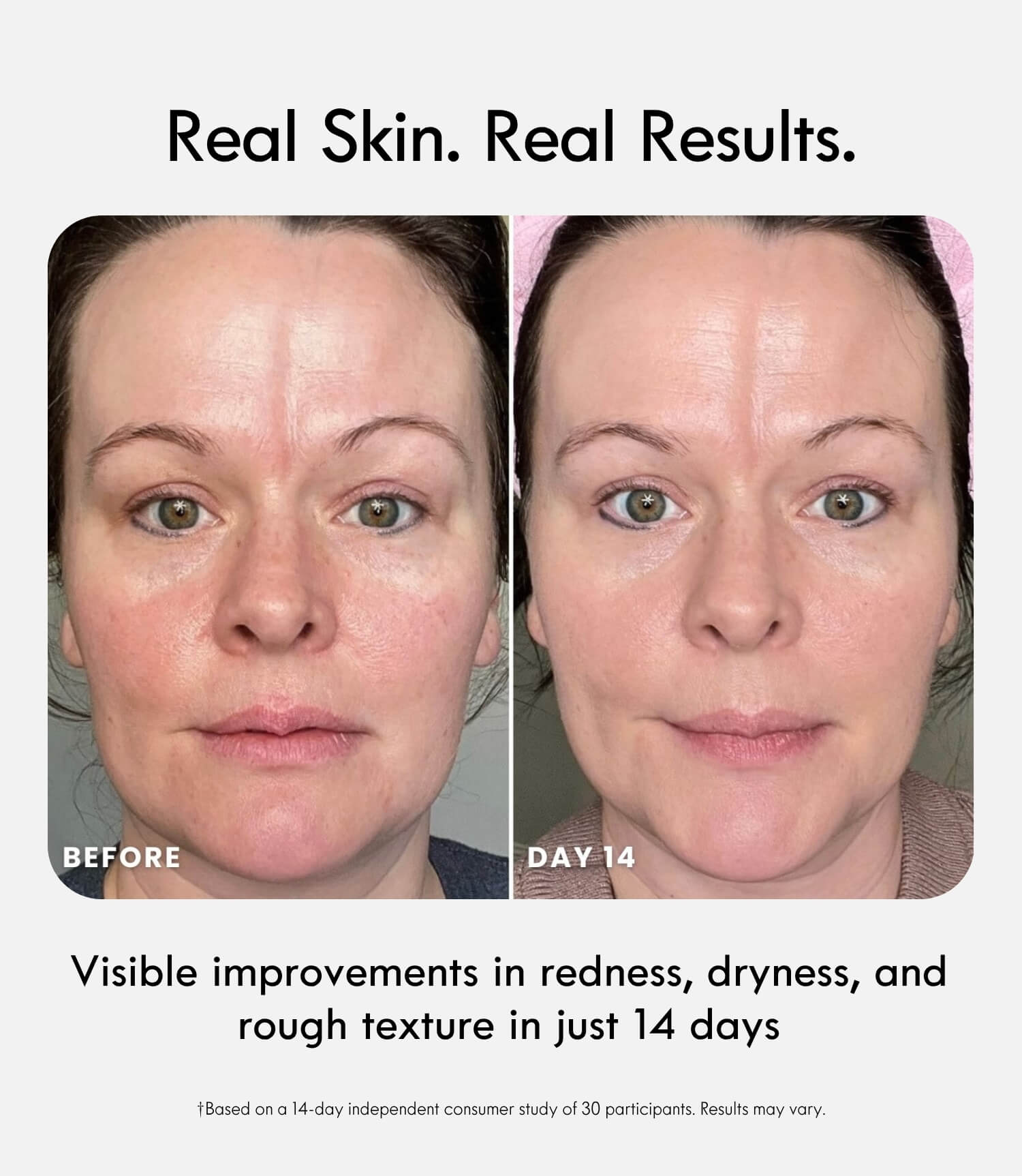 Bio-Adaptive Recovery Cream - Laduora