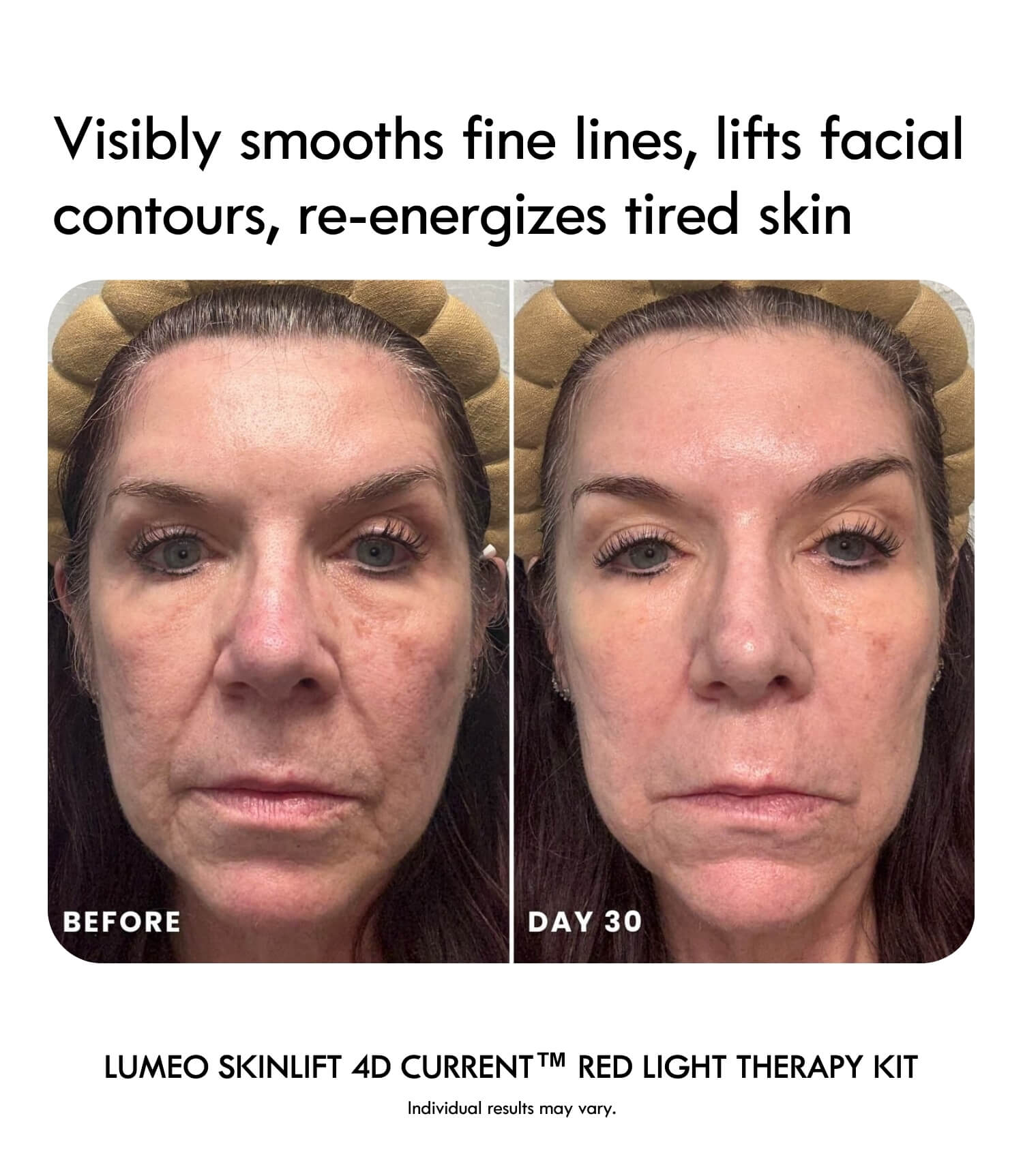 Laduora Lumeo 4-in-1 Red Light Therapy Device