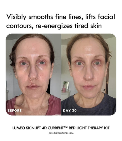 Laduora Lumeo 4-in-1 Red Light Therapy Device