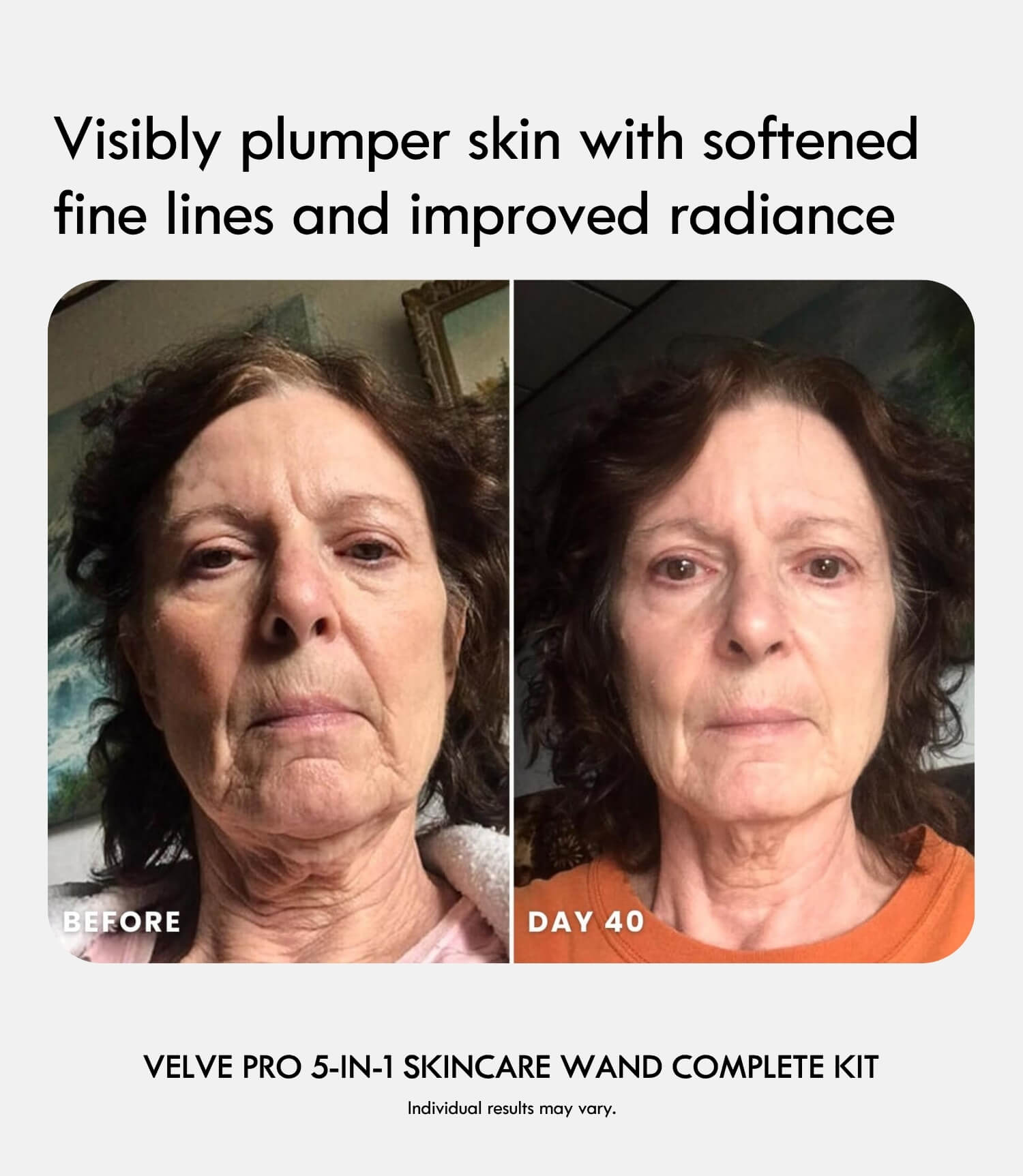 Velve Pro 5 - in - 1 Skincare Wand Complete Kit - Laduora
