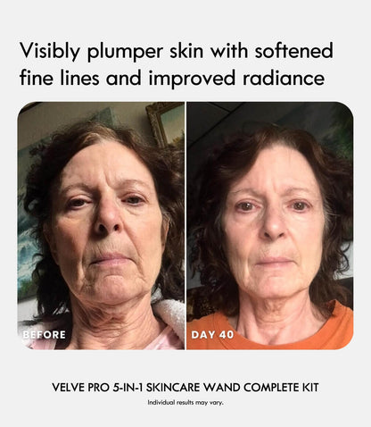 Velve Pro 5 - in - 1 Skincare Wand Complete Kit - Laduora